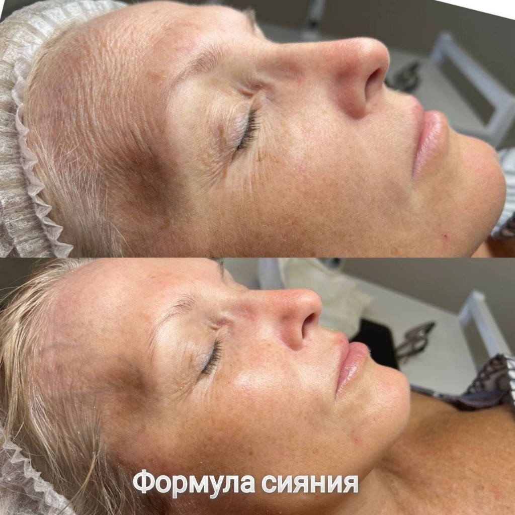 Эстетическая косметология, работа 2 — формула сияния