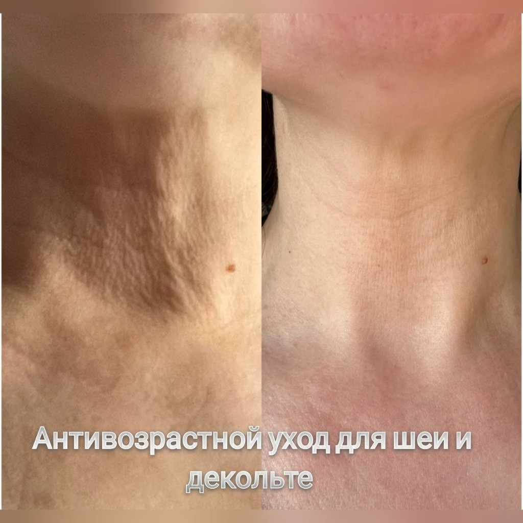 Эстетическая косметология, работа 4 — уход для шеи и декольте